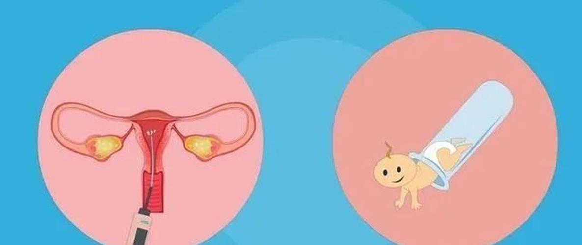 借卵生子到哪里做【借卵生子:选择何处才是最佳之地】
